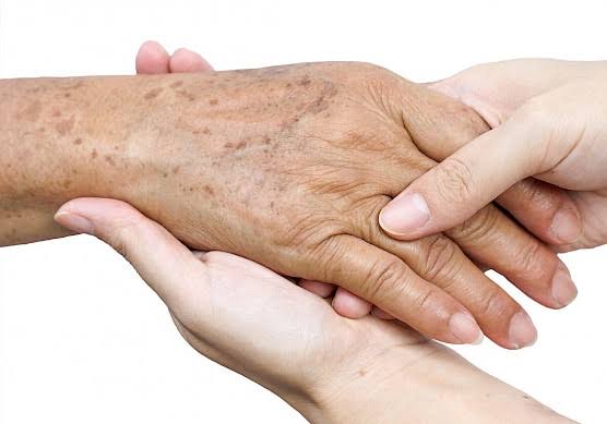A doença de pele em idosos é maior e mais preocupante.